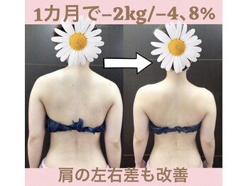 スワン 新栄店(SWAN)/挙式1カ月前→駆け込み劇的変化