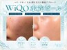 人気No.4【開き毛穴】WiQo水光ピール+3S毛穴洗浄+プラズマ+ポレーション
