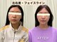整音(totonone)の写真