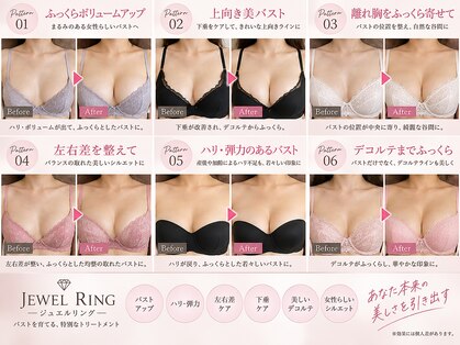 ジュエルリング(Jewel Ring)の写真