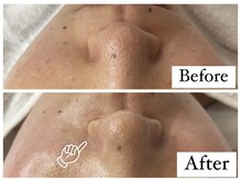 イオ(iO)/ー ワックス &nbsp;Before/After ー