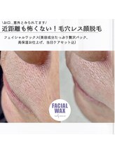 セレーノ(Sereno)/意外とみられてます！口元の産毛