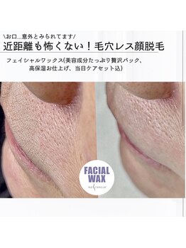 セレーノ(Sereno)/意外とみられてます！口元の産毛