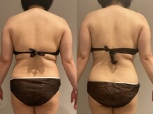 エステティック ミュー(Esthetic MiEUX)/全身痩身コース