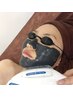 【繰り返すニキビにお悩みの方へ】全顔ブラックピーリング/剥離無し/美肌効果