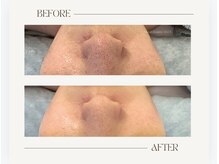 アリー(ALLY)/艶肌wax