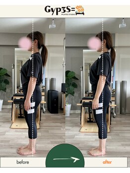 ジップス(Gyp3S=)/たったの2回でもこの違い！