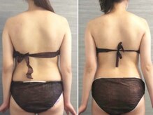 美容整体ウェリナ あま甚目寺院/小顔矯正/骨盤矯正/美脚サロン