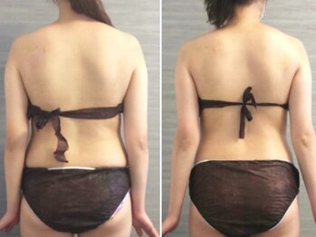 美容整体ウェリナ あま甚目寺院/小顔矯正/骨盤矯正/美脚サロン