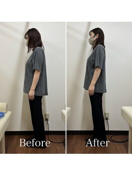 宮町鍼灸整骨院/産後骨盤矯正