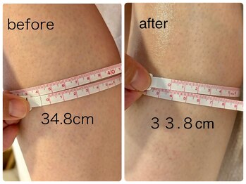 チル アンド リラックス(Chill and Relax)/むくみやすい方へ