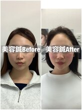 ハリサロンドオフ 堺東店(hari salon de off)/お客様のbefore→after