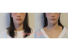 整体いったんとこ/美容整体フルコース