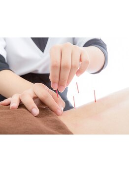 鍼灸施術を受けたい