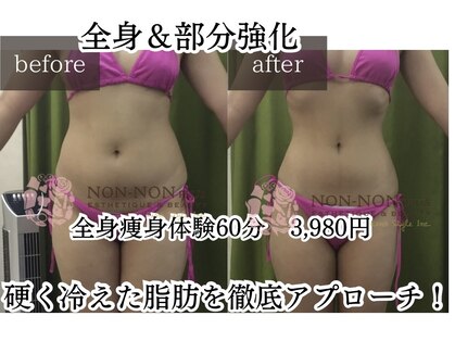 ノンノンプラス 博多(NON-NONプラス)の写真