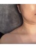 メイクの上からOK！？時短美容・次世代美容サーマルフラクショナル１５分　　