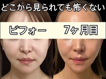 ココ(COCO)の雰囲気（続ける事で蓄積美容が出来、将来の美容貯金◎たるませない）