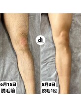 ビューティーサロン マル(Beauty Salon MARU)/