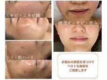 ヨルエステ(yoru aesthe)