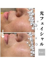 ソイ(Soi)/光照射でお肌クリアに♪