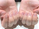 スカルプ長さ出し/深爪解消