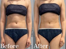 ベルクーレ(Belle cure)/ウエストすっきり！