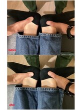 サンテ鍼灸院 整骨院/before/after