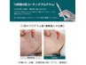 【毛穴縮小！】韓国iLLON肌質改善&小顔フェイシャル￥18,700→￥16,500