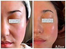 ゾーンビューティーハウス 松戸店(ZONE BEAUTY HOUSE)の雰囲気（フルオプション肌質集中改善コース有 肌質結果★）
