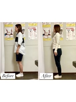 体の歪みをとりたい