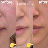 ラズリ(LazuLuLy)