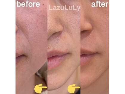 ラズリ(LazuLuLy)の写真