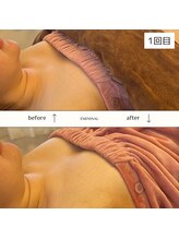 エミニナル(EMININAL)/【バストケア】ビフォーアフター