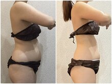 ウェリナ平和堂長久手院/小顔矯正/骨盤矯正/美脚サロン