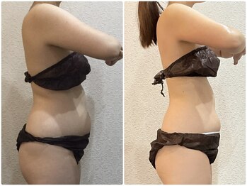 ウェリナ平和堂長久手院/小顔矯正/骨盤矯正/美脚サロン