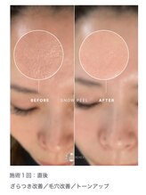 ユキエル(yukielle)/ビフォーアフター