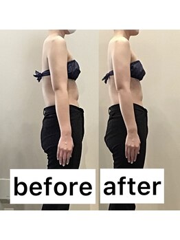 エスデザイン(es design)/巻肩/パワーレメディ/ブライダル