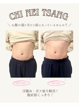 ルアーナエクリュ(Luana ecru)/チネイザン（腸もみ）