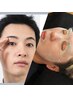 【¥15,000→¥13,500】モテ眉＋フェイシャルワックス(ひげ除く全顔)