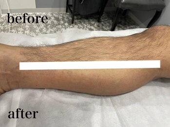 ジョアアンジェ 京橋店(joie ange)/脚ワックス