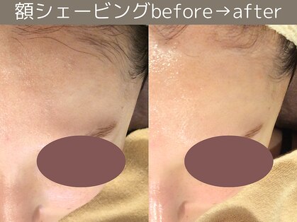 ももとゆでたまごの写真