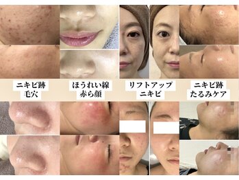 ミュレア 新宿本店(mulea)