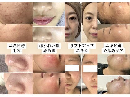 ミュレア 新宿本店(mulea)の写真