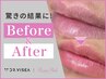 ローマピンクリップ唇キャンペーン【アフタークリームプレゼント】
