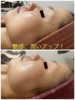 エステサロン エレガンス/