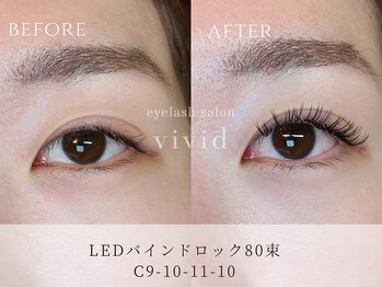 ビビッド(vivid)/【LEDバインドロック80束】