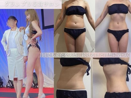 キララ(Kirara)の写真