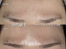 コウル 川西能勢口店(geoul)/透明感アップコース
