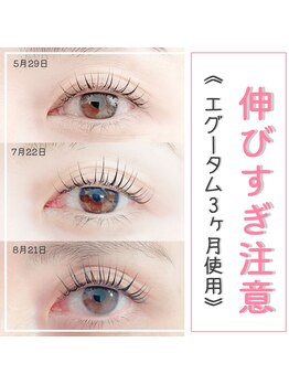 ウィンク 勝どき(wink)/まつげパーマ(ラッシュリフト)