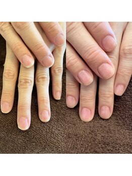 トゥルーケア(TRUE CARE)/ハンドネイルケア